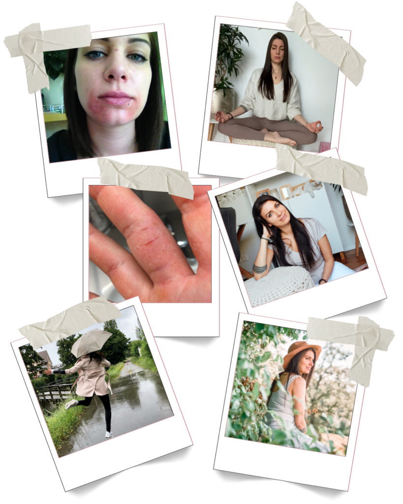 Fotos